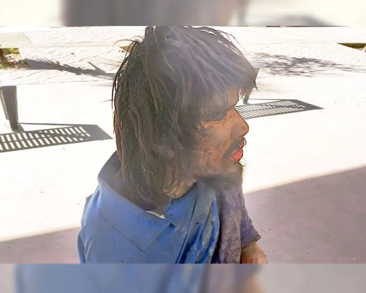 Hombre atropellado pierde mano y se niega a atención médica