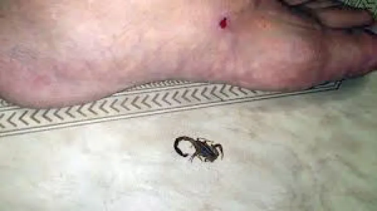 Llaman a evitar remedios caseros