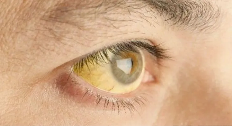 Llaman a evitar comer en la calle