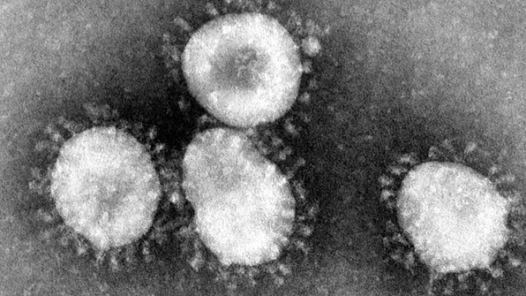 Alarma Coronavirus en Estados Unidos