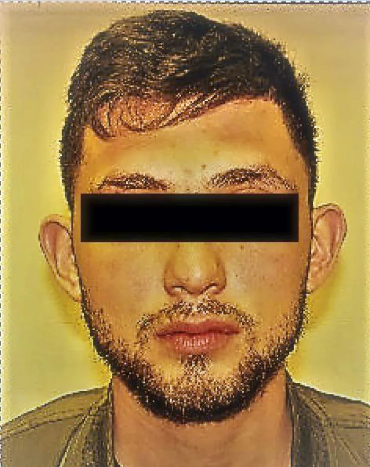 Vinculado al Delito de Sedición