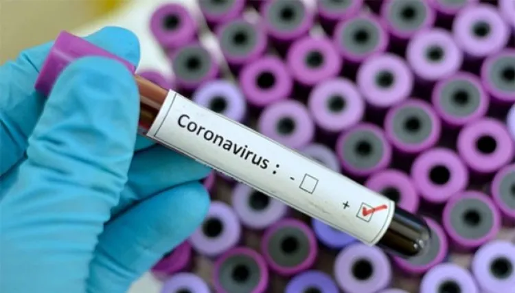 Reportan cuarto fallecimiento por coronavirus en Sinaloa