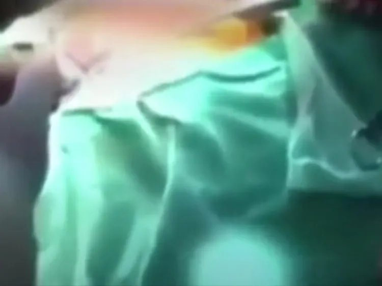 Pese a sismo de 7.5, cirugía a corazón abierto sigue adelante