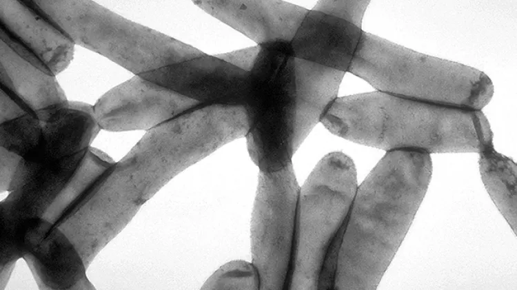 Localizan bacteria en edificios abandonados