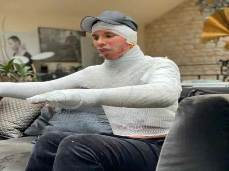 Olivier Rousteing, diseñador de Balmain revela que sufrió graves quemaduras