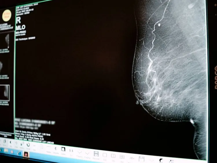 Cáncer de mama: Autoexplórate, esta práctica puede salvar tu vida