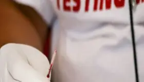 A casi 40 años de la pandemia del SIDA ¿por qué todavía no hay vacuna?