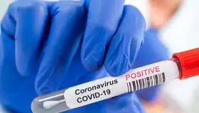 Registra Sonora 58 casos y una defunción por Covid-19