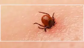 Llaman a prevenir enfermedades como la Rickettzia