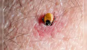 Alertan sobre presencia de garrapatas en patios