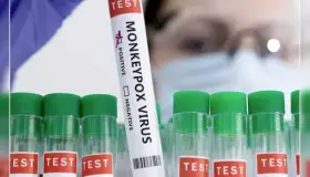 Estudian modos de transmisión de viruela símica