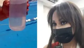 Detectan ‘amiba de vida libre’ en albercas públicas