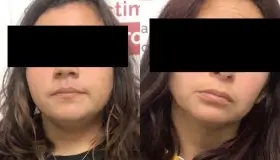 Detienen a dos mujeres con armas y droga