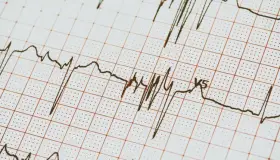 Ofrecerá Salud Municipal servicio de electrocardiograma gratuito