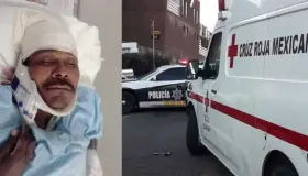 Queda al filo de la muerte persona atropellada