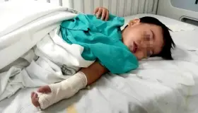 Urgen traslado de bebé con tumor en cabeza