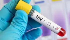 Aumentan 30 por ciento casos de VIH en Europa