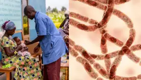 Alerta la OMS contagios de ántrax en África