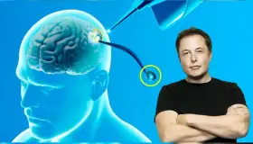 Implantan primer chip cerebral con Neuralink