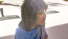 Hombre atropellado pierde mano y se niega a atención médica