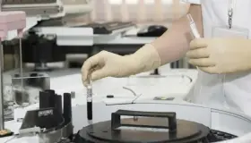 Mantienen alerta en Jalisco por brote infeccioso; suman 62 afectados