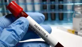 Aumenta hepatitis A en Estado de Arizona