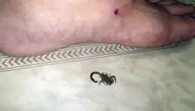 Llaman a evitar remedios caseros