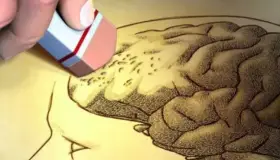 Hallan proteína del cerebro que retrasa avance del Alzheimer