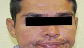 Sentencian a “El Educado” a diez años por asalto bancario