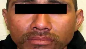 Hermosillo: Detienen a agresor de guardia de seguridad  