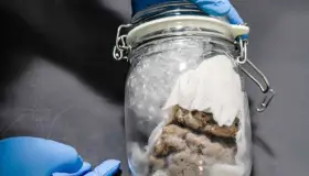 Decomisan cerebro enviado por correo