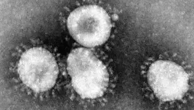 Alarma Coronavirus en Estados Unidos