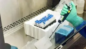 Denuncian que domina lentitud y opacidad en pruebas de coronavirus