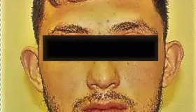 Vinculado al Delito de Sedición