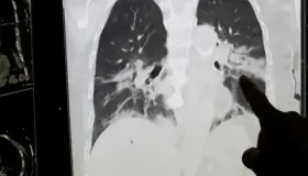 El coronavirus nos acompañará durante mucho tiempo: OMS