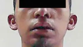 Detenido por agredir a matrimonio con machete