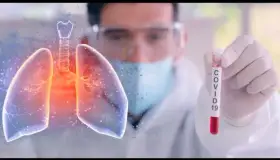 Nogales, en riesgo por Covid